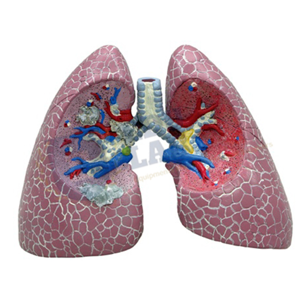 Human Lung Model