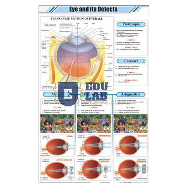 Eye and its Defects Chart